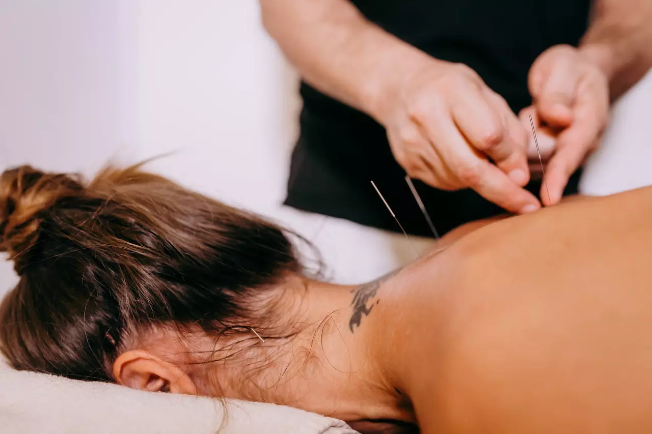 Can Acupuncture Help With Anxiety