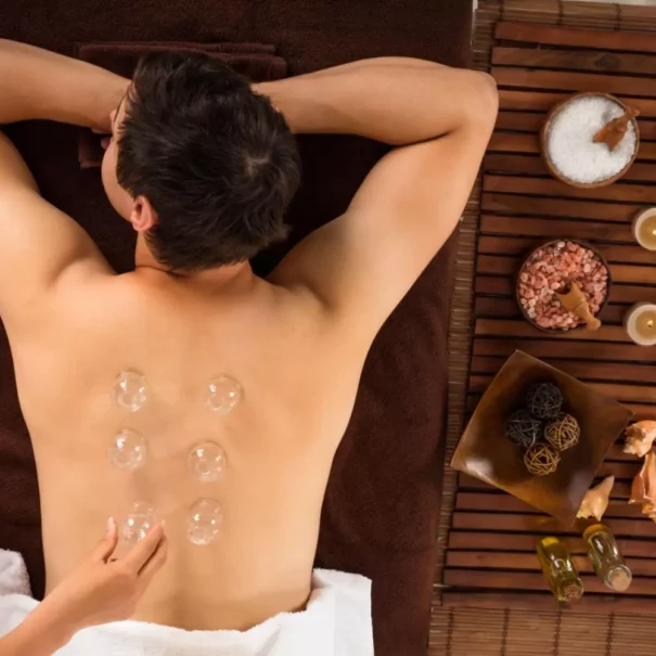 What does cupping do for your back