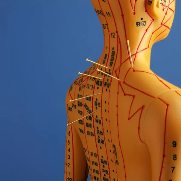 is acupuncture painful