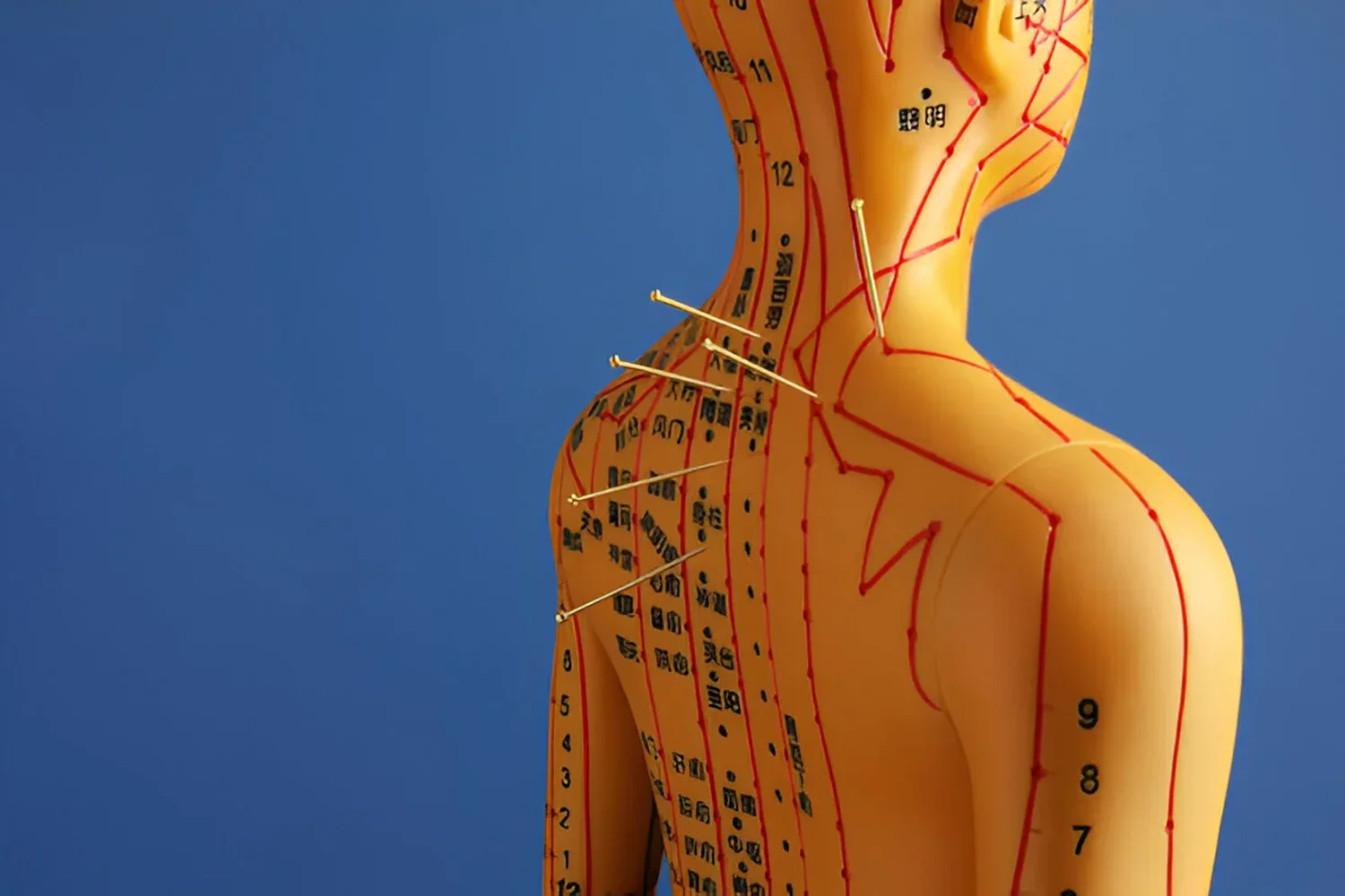 is acupuncture painful