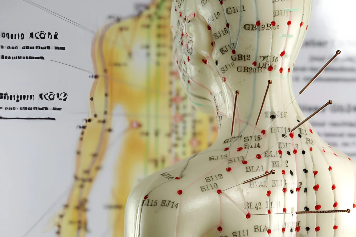 what does it mean when acupuncture hurts