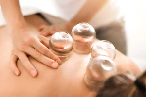 benefits of cupping for athletes