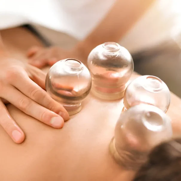 benefits of cupping for athletes