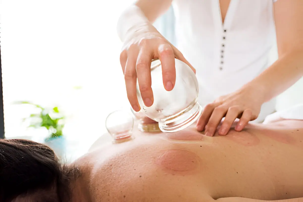 cupping for athletes